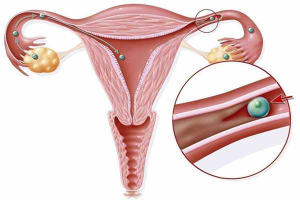 <b>习惯性流产的前兆_女孩子宫切除病例,卵巢早衰能不能进行试管婴儿</b>